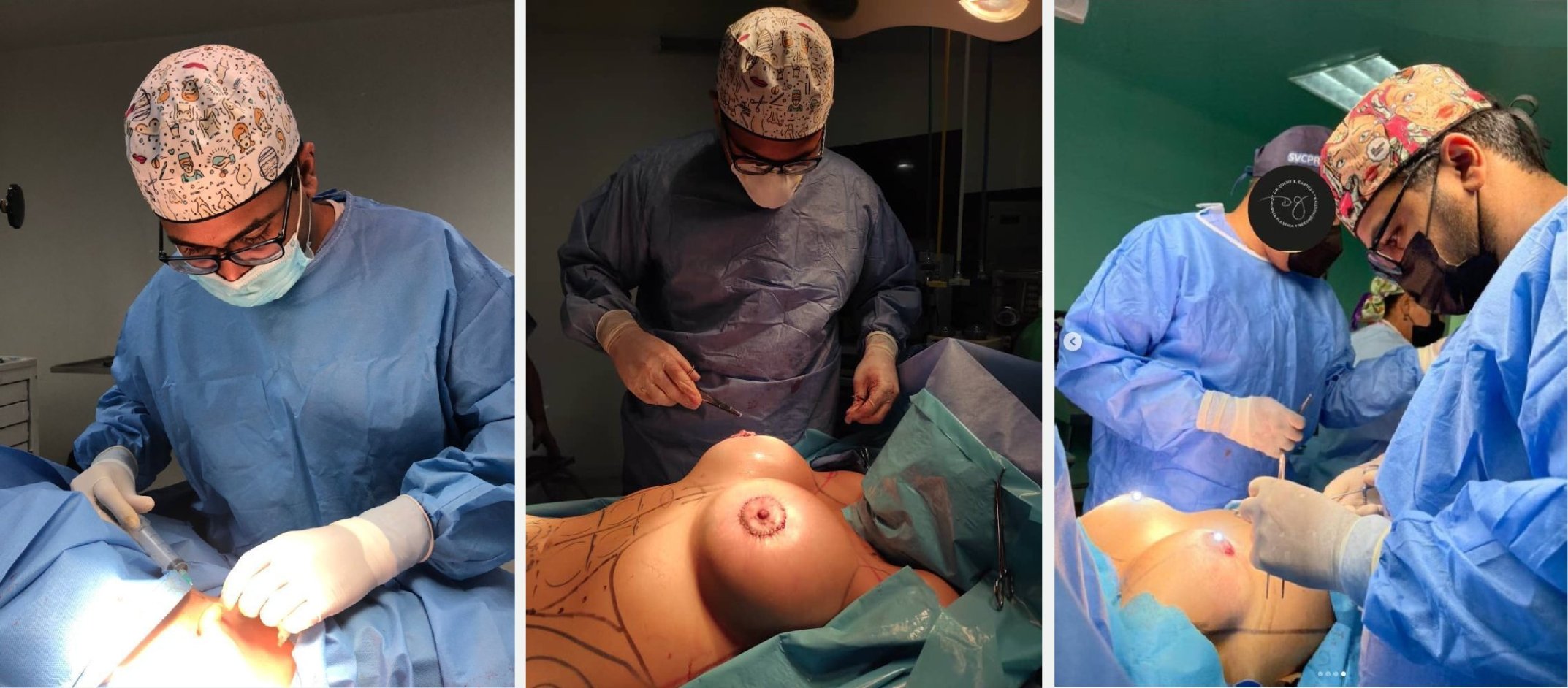 LIPOSUCCION REPUBLIQUE DOMINICAINE